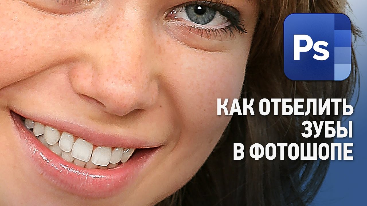 Как научиться улыбаться с зубами естественно?